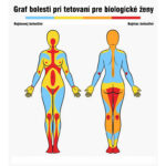 Miesta bolesti pri tetovaní. 5 mapa-bolesti-zeny-web